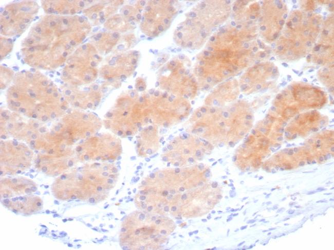 Beta-Parvin Antibody in Immunohistochemistry (Paraffin) (IHC (P))