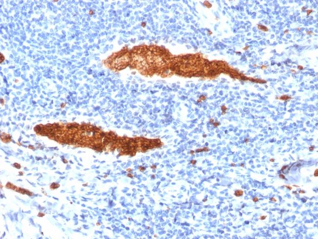 Glycophorin A/CD235a (Erythrocyte Marker) Antibody in Immunohistochemistry (Paraffin) (IHC (P))