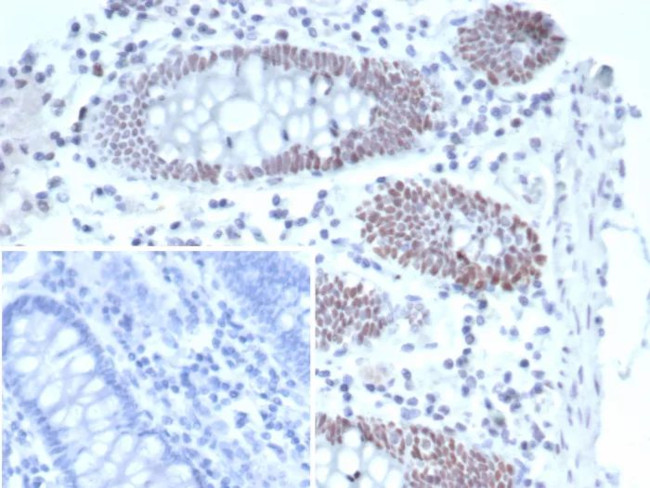 T-bet/Tbox-bet/TBX21 Antibody in Immunohistochemistry (Paraffin) (IHC (P))