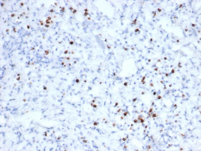 Granzyme B (NK/T-Cell Lymphoma Marker) Antibody in Immunohistochemistry (Paraffin) (IHC (P))