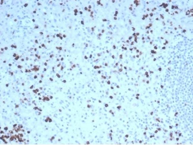 Granzyme B (NK/T-Cell Lymphoma Marker) Antibody in Immunohistochemistry (Paraffin) (IHC (P))