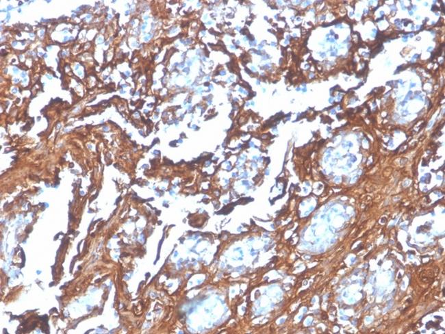 Annexin A1/ (Hairy Cell Leukemia Marker) Antibody in Immunohistochemistry (Paraffin) (IHC (P))