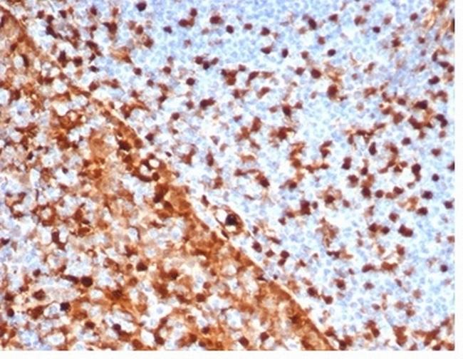 Annexin A1/ (Hairy Cell Leukemia Marker) Antibody in Immunohistochemistry (Paraffin) (IHC (P))