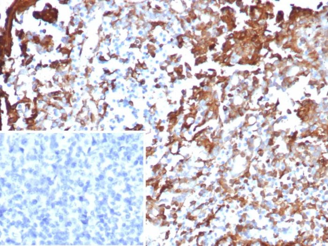 Annexin A1/(Hairy Cell Leukemia Marker) Antibody in Immunohistochemistry (Paraffin) (IHC (P))