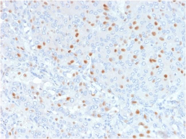 Annexin A1/ (Hairy Cell Leukemia Marker) Antibody in Immunohistochemistry (Paraffin) (IHC (P))