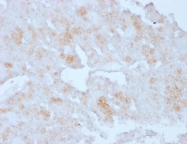 Annexin A1/ (Hairy Cell Leukemia Marker) Antibody in Immunohistochemistry (Paraffin) (IHC (P))