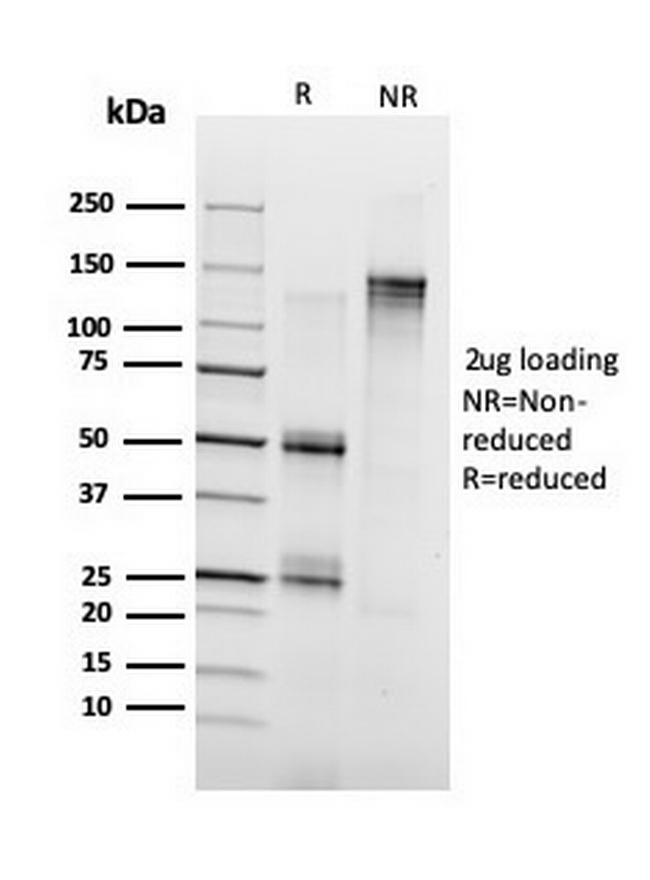 Annexin A1/ (Hairy Cell Leukemia Marker) Antibody in SDS-PAGE (SDS-PAGE)