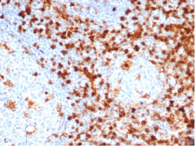 Annexin A1/(Hairy Cell Leukemia Marker) Antibody in Immunohistochemistry (Paraffin) (IHC (P))