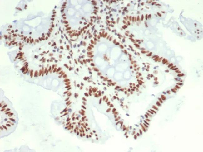 HDGF Antibody in Immunohistochemistry (Paraffin) (IHC (P))