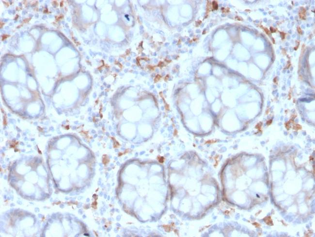 CD209/DC-SIGN (Pathogen Receptor on Dendritic Cells) Antibody in Immunohistochemistry (Paraffin) (IHC (P))