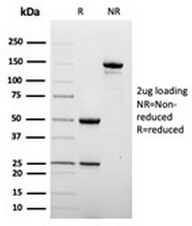 CD209/DC-SIGN (Pathogen Receptor on Dendritic Cells) Antibody in SDS-PAGE (SDS-PAGE)