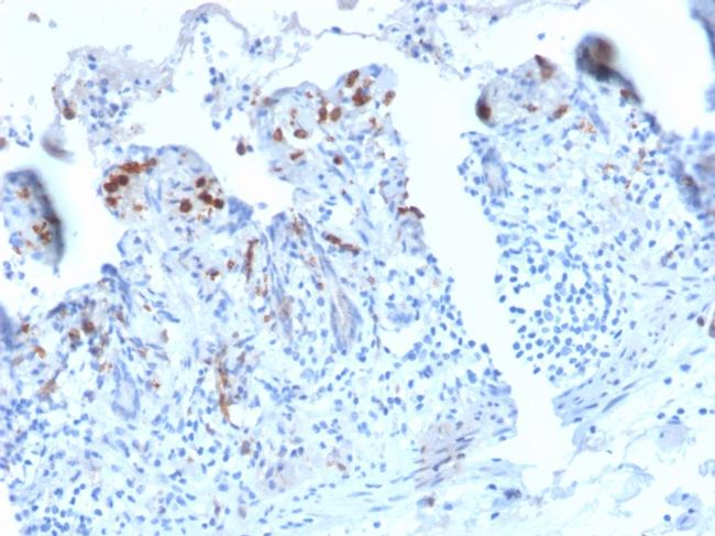 CD209/DC-SIGN (Pathogen Receptor on Dendritic Cells) Antibody in Immunohistochemistry (Paraffin) (IHC (P))