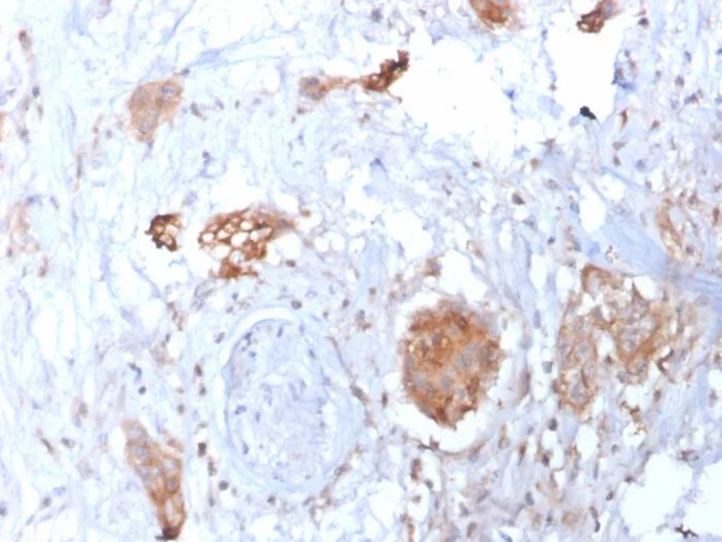 HIF1 alpha (Hypoxia-Inducible Factor 1-alpha) Antibody in Immunohistochemistry (Paraffin) (IHC (P))