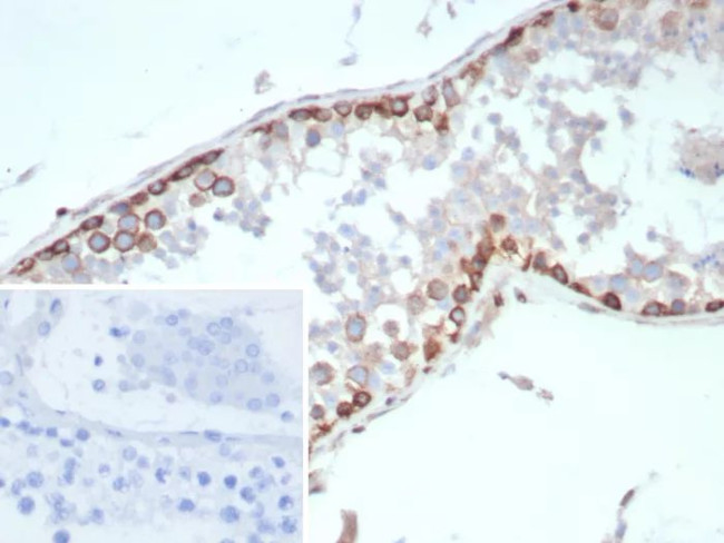 HIF1 alpha (Hypoxia-Inducible Factor 1-alpha) Antibody in Immunohistochemistry (Paraffin) (IHC (P))