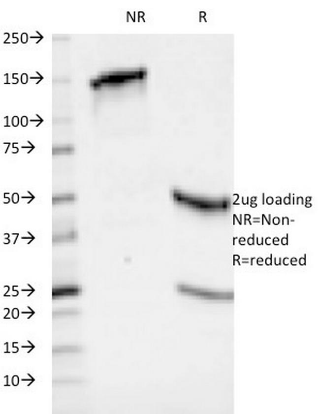 HLA-ABC (MHC I) Antibody in SDS-PAGE (SDS-PAGE)