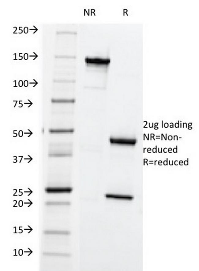 HLA-ABC (MHC I) Antibody in SDS-PAGE (SDS-PAGE)