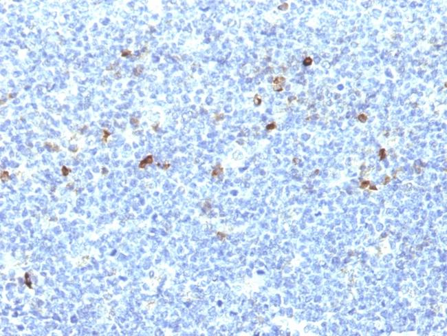 HLA-Aw32 and HLA-A25 (MHC I) Antibody in Immunohistochemistry (Paraffin) (IHC (P))