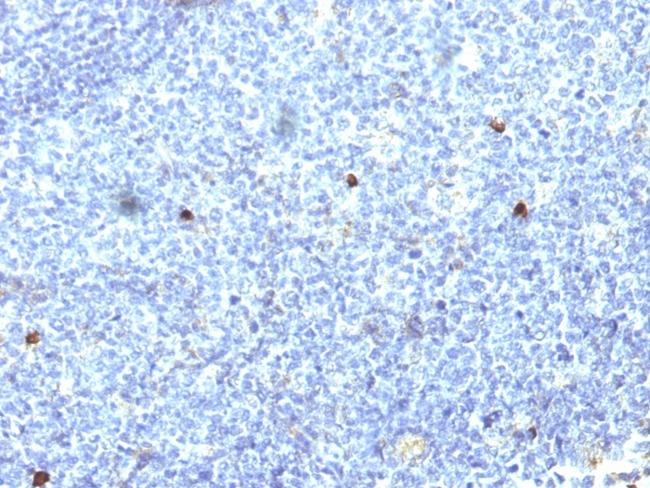 HLA-Aw32 and HLA-A25 (MHC I) Antibody in Immunohistochemistry (Paraffin) (IHC (P))