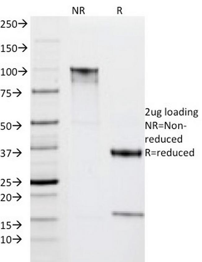 HLA-DRA (MHC II) Antibody in SDS-PAGE (SDS-PAGE)