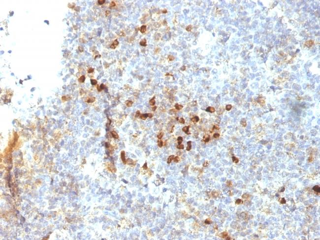 HLA-DRA (MHC II) Antibody in Immunohistochemistry (Paraffin) (IHC (P))