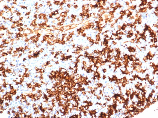 HLA-DR (MHC II) Antibody in Immunohistochemistry (Paraffin) (IHC (P))