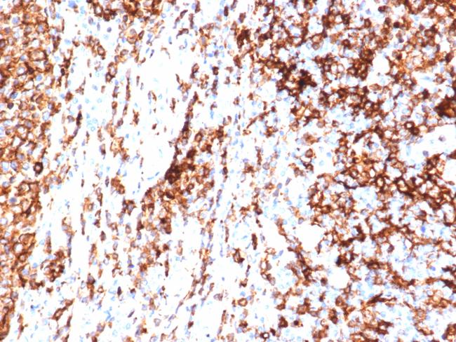 HLA-DR (MHC II) Antibody in Immunohistochemistry (Paraffin) (IHC (P))