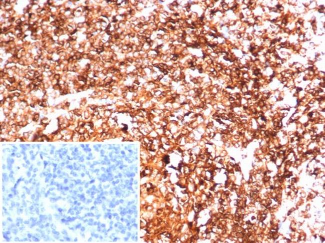 HLA-DR (MHC II) Antibody in Immunohistochemistry (Paraffin) (IHC (P))