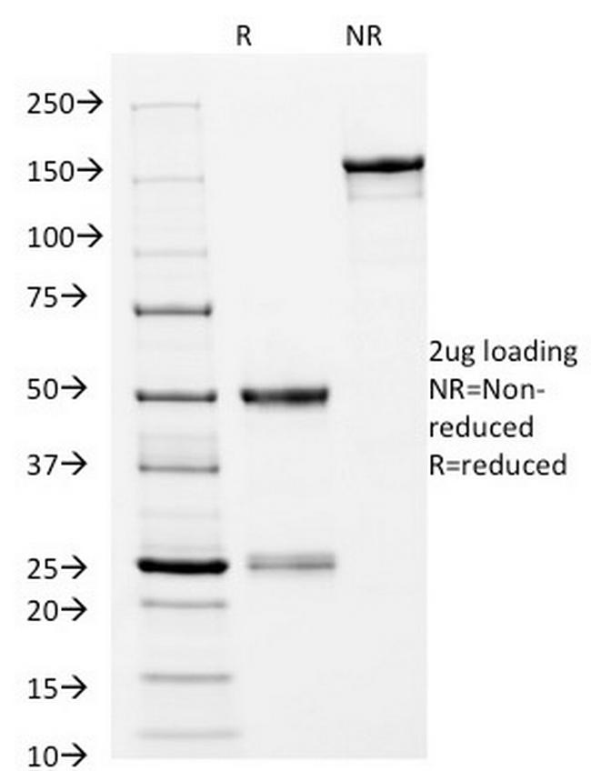 HLA-DRB (MHC II) Antibody in SDS-PAGE (SDS-PAGE)