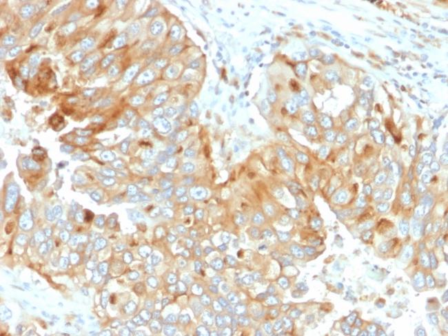 HLA-DRB (MHC II) Antibody in Immunohistochemistry (Paraffin) (IHC (P))