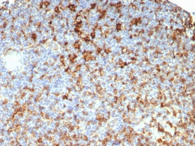 HLA-DRB (MHC II) Antibody in Immunohistochemistry (Paraffin) (IHC (P))