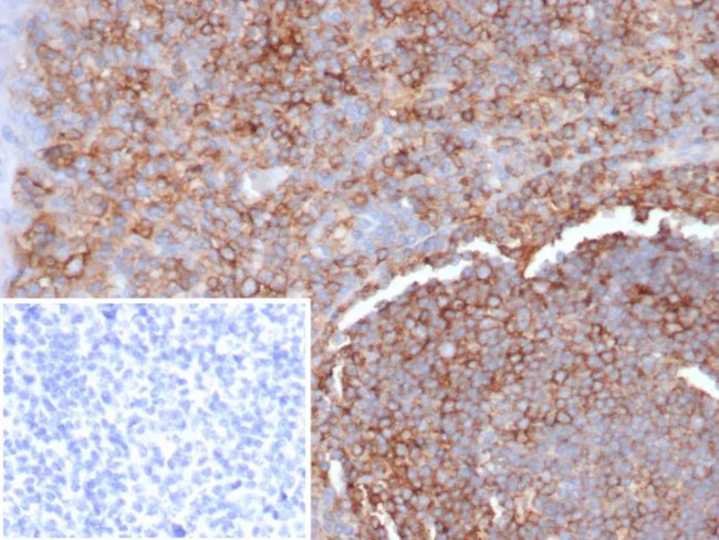 HLA-G (Major Histocompatibility Complex, class I, G) Antibody in Immunohistochemistry (Paraffin) (IHC (P))