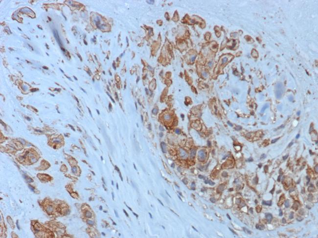 HLA-G (Major Histocompatibility Complex, class I, G) Antibody in Immunohistochemistry (Paraffin) (IHC (P))