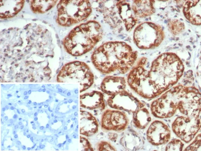 MR1/Major histocompatibility complex, class I-related Antibody in Immunohistochemistry (Paraffin) (IHC (P))