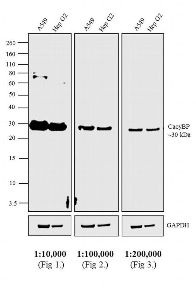 Rabbit IgG (H+L) Secondary Antibody in Western Blot (WB)