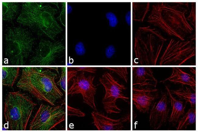 Mouse IgG (H+L) Cross-Adsorbed Secondary Antibody in Immunocytochemistry (ICC/IF)