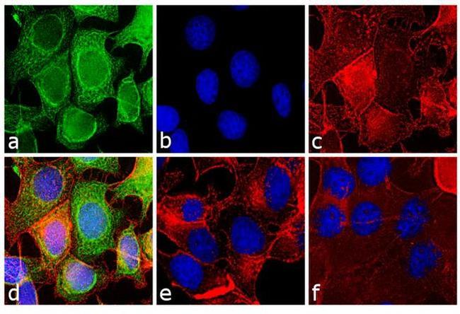 Mouse IgG (H+L) Secondary Antibody in Immunocytochemistry (ICC/IF)