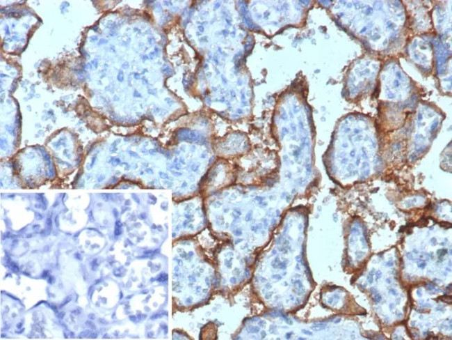 CD168/RHAMM Antibody in Immunohistochemistry (Paraffin) (IHC (P))