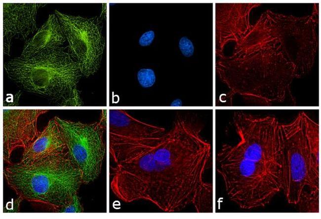 Rat IgG (H+L) Secondary Antibody in Immunocytochemistry (ICC/IF)