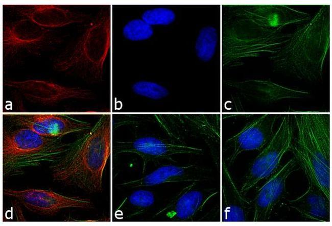 Mouse IgG Fc Secondary Antibody in Immunocytochemistry (ICC/IF)