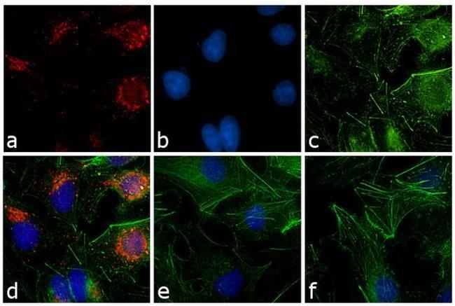 Rabbit IgG (H+L) Secondary Antibody in Immunocytochemistry (ICC/IF)