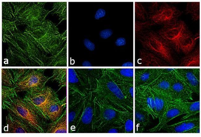 Rat IgG (H+L) Secondary Antibody in Immunocytochemistry (ICC/IF)