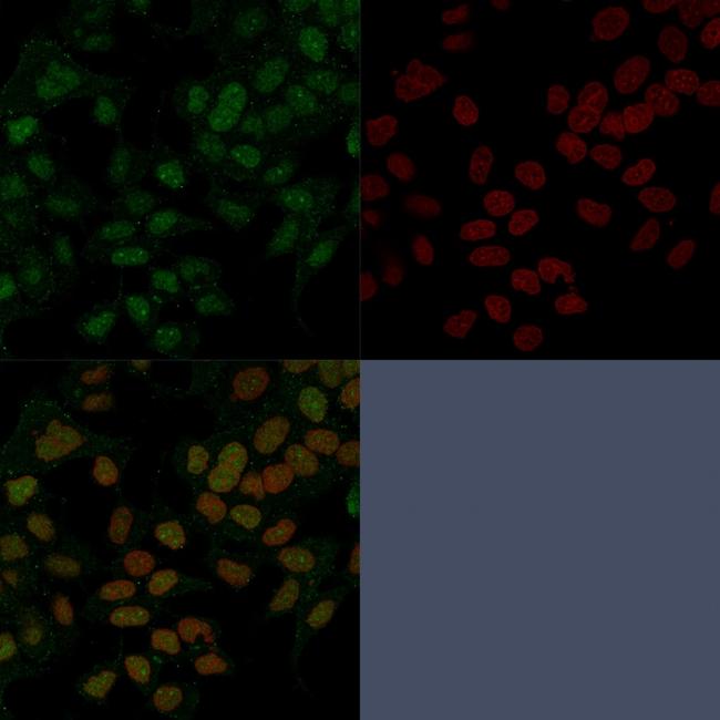 FOXA1/HNF3A Antibody in Immunocytochemistry (ICC/IF)