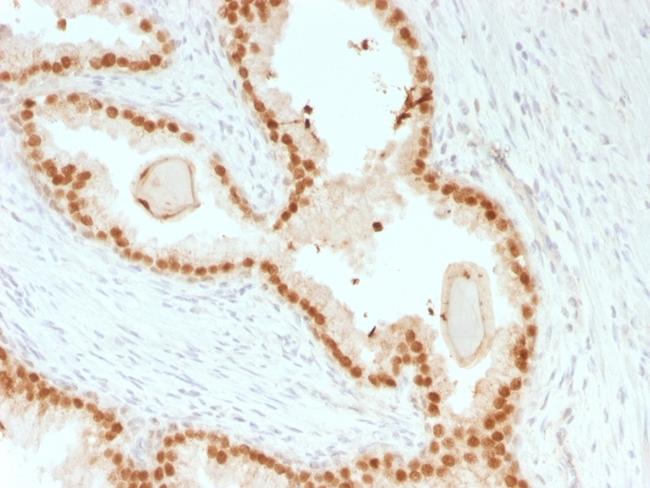 FOXA1/HNF3A Antibody in Immunohistochemistry (Paraffin) (IHC (P))