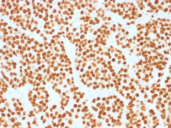 FOXA1/HNF3A Antibody in Immunohistochemistry (Paraffin) (IHC (P))