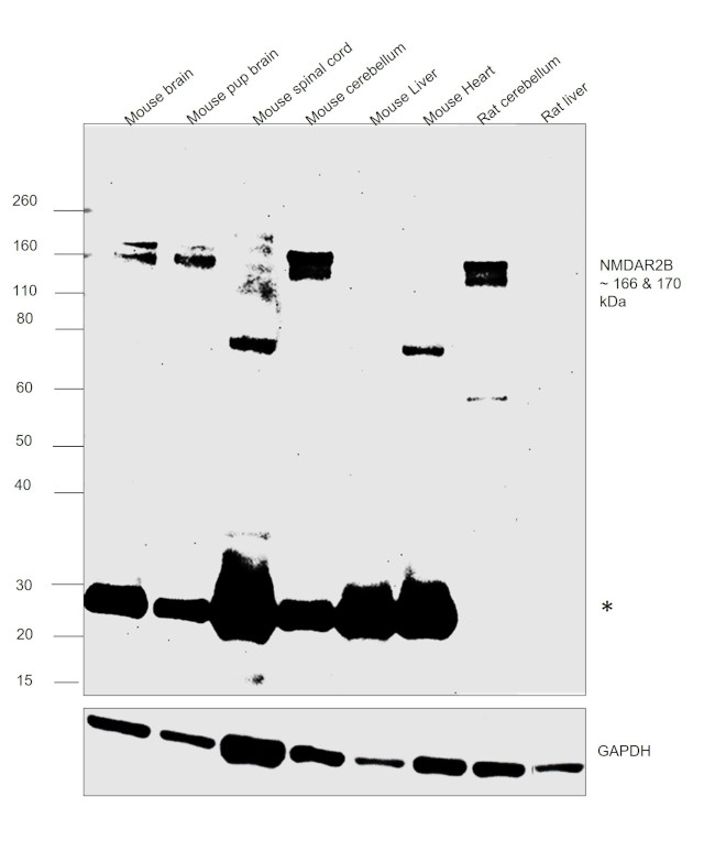 NMDAR2B Antibody in Western Blot (WB)