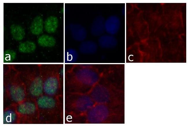 Cyclin E Antibody in Immunocytochemistry (ICC/IF)