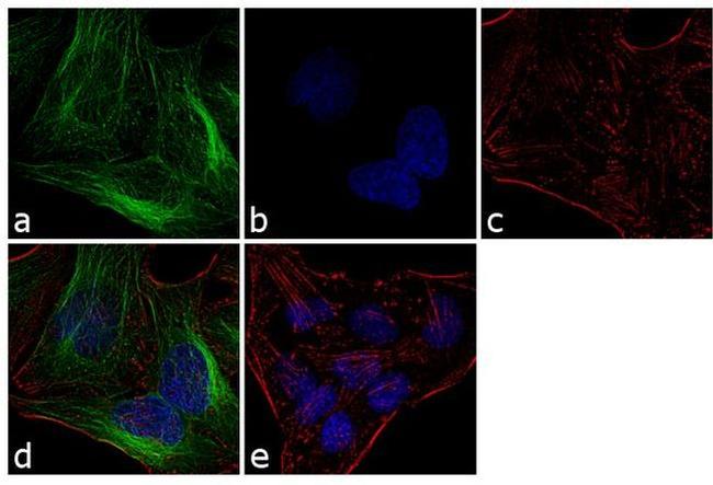 alpha Tubulin Antibody in Immunocytochemistry (ICC/IF)