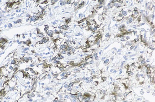 alpha Internexin Antibody in Immunohistochemistry (IHC)