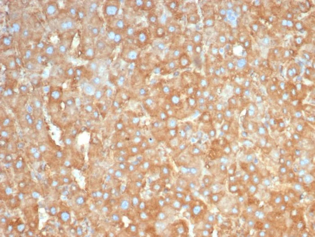 Haptoglobin (HP) Antibody in Immunohistochemistry (Paraffin) (IHC (P))