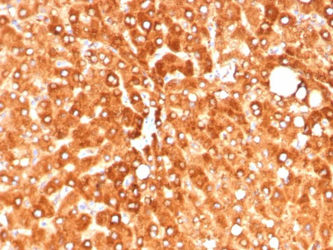 Haptoglobin (HP) Antibody in Immunohistochemistry (Paraffin) (IHC (P))